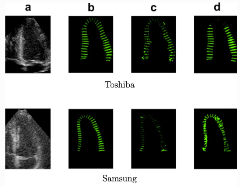 echocardiogram